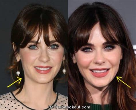 zooey deschanel filler|Zooey Deschanel Plastic Surgery Comparison Photos。